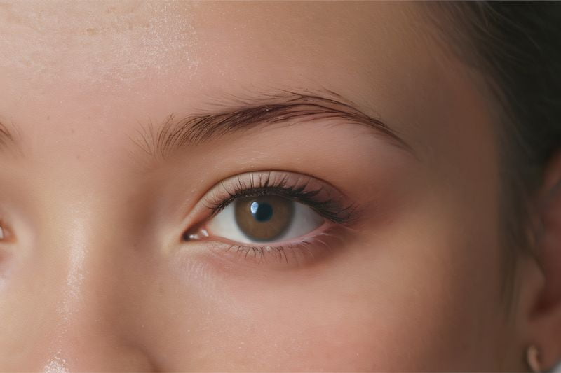 四、济宁人都在问的近视手术5大问题