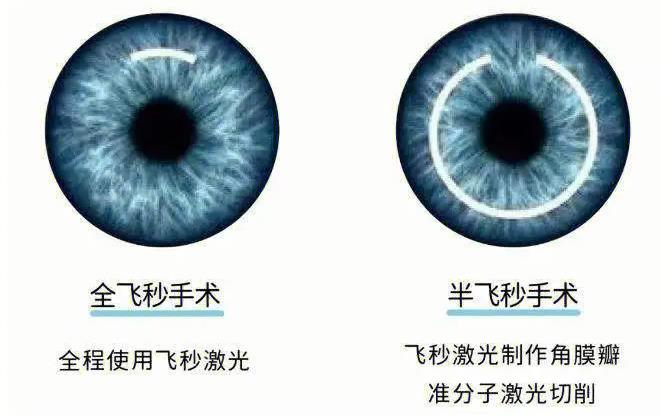 三、玉林爱尔眼科医院价格表｜术前检查与视力评估费用www.89yo.com