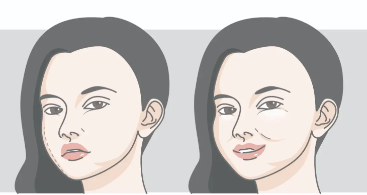 周云超修复馒化脸怎么样？亲测解析技术优势：减提塑三重策略，价格1.8万起不贵