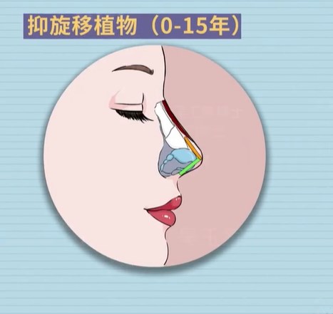 杨万忠隆鼻哪个医院？在西安国医整形还是画美？2026价格案例大起底揭秘！
