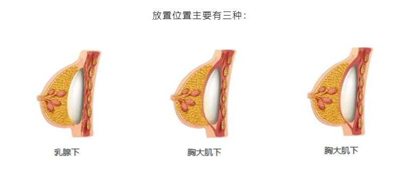 三、如何根据需求选择医生?实用指南
