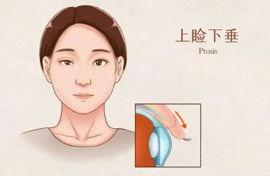 大连刘志刚眼整形修复怎么样？尤其擅长处理多次失败的复