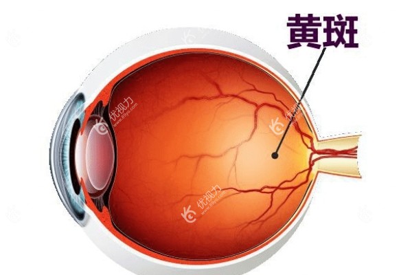 年轻人/老人眼睛黄斑病变怎么治疗好 年轻人/老人眼睛黄斑病变怎么治疗好