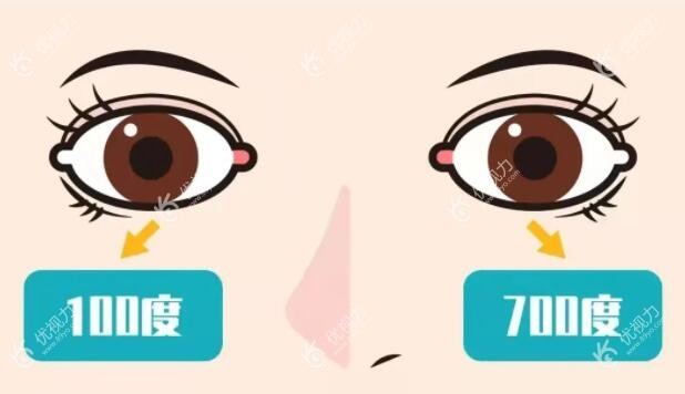 两个眼睛度数不一样能做近视手术吗