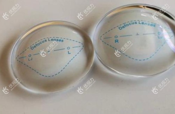 prl晶体植入手术费用