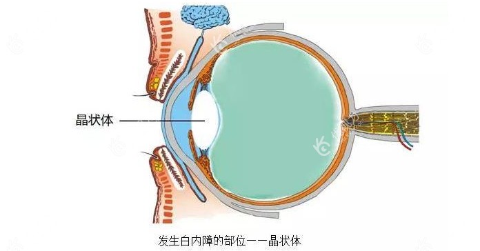 上海五官科医院眼科专科开阵白内障手术