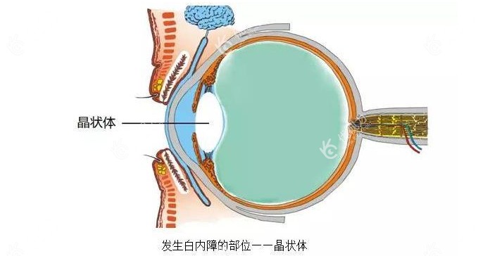 <!--<i data=20240710-cj></i>-->眼科专科开阵白内障手术