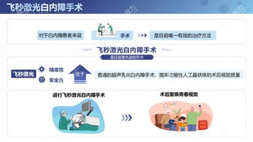 激光飞秒白内障手术