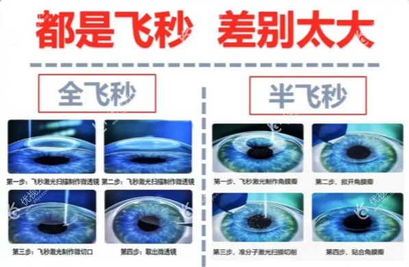 全飞秒和半飞秒的价格区别大是为什么呢？