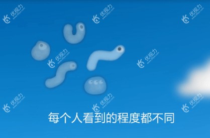 飞蚊症的视觉差异化