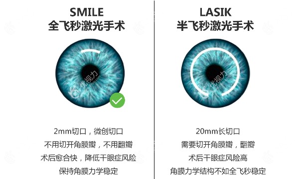 做完飞秒手术之后可以达到1.0以上吗
