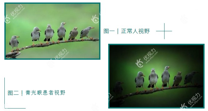 张图测试自己是否有青光眼参考