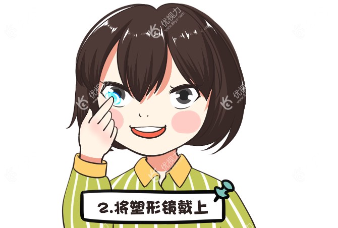 上海儿童角膜塑形镜哪家医院好
