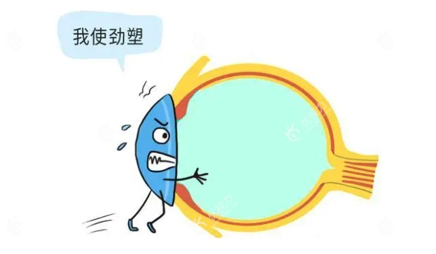 儿童角膜塑形镜的利与弊有哪些www.89yo.com