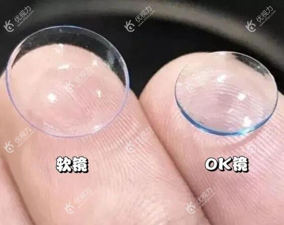 7岁孩子散光300度戴角膜塑形镜矫正
