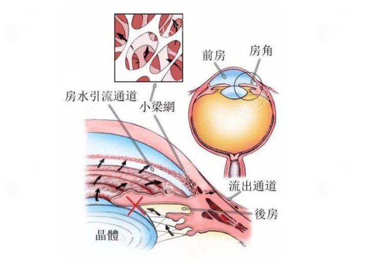 眼睛房角结构