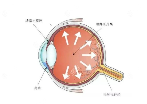 房水