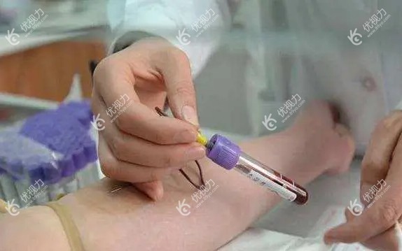 近视手术验血