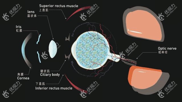 ICL晶体植入手术到底有何危害呢