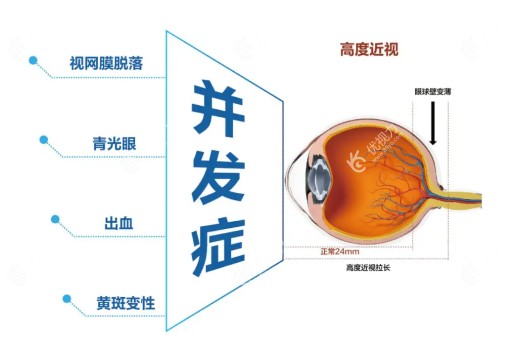 检查与预防www.89yo.com