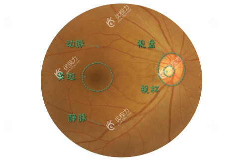 出现病变的眼睛