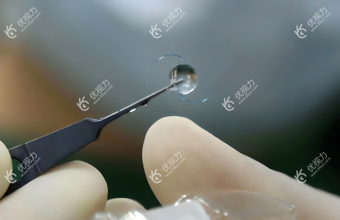 需要更换人工晶体的症状表现
