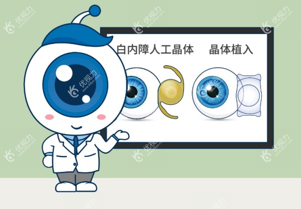 白内障晶体植入手术模糊咋回事